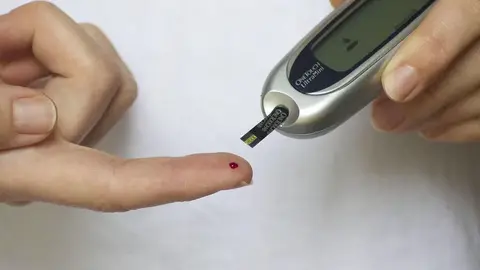 新婚備孕遇阻礙,第一型糖尿病女性靠智慧控糖系統擺脫頻繁扎針(示意圖)